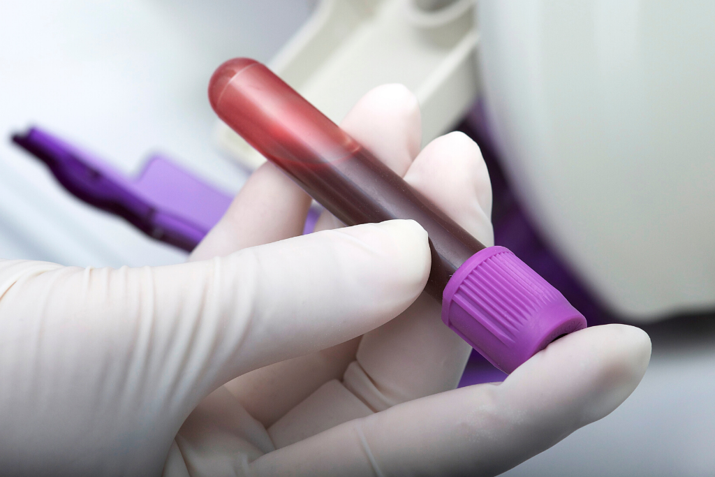 CDC begins antibody testing - UponArriving